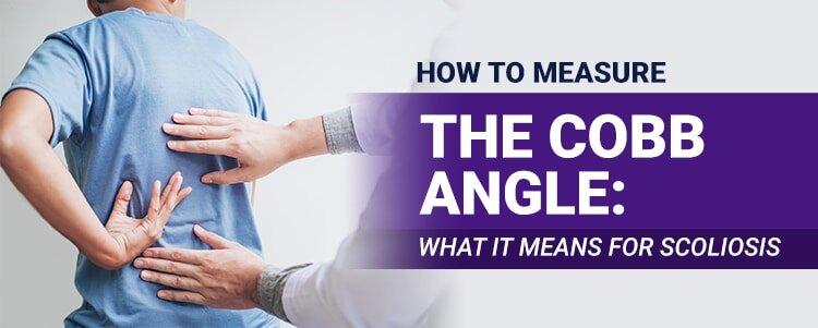 How to Measure the Cobb Angle: What it Means for Scoliosis