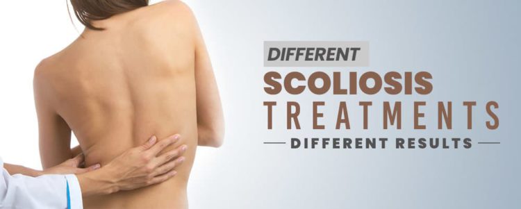 Different Scoliosis Treatments, Different Results