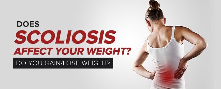 Does Scoliosis Affect Your Weight? Do You Gain/Lose Weight?