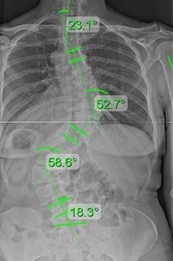 elderly 2 weeks in