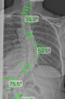 elderly pre treatment