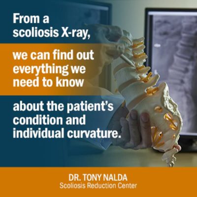 from a scoliosis small