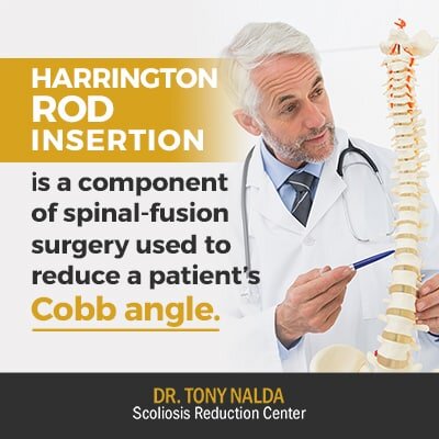 harrington rod insertion is a component