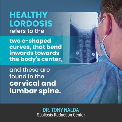 healthy lordosis refers to the 400 healthy lordosis refers to the
