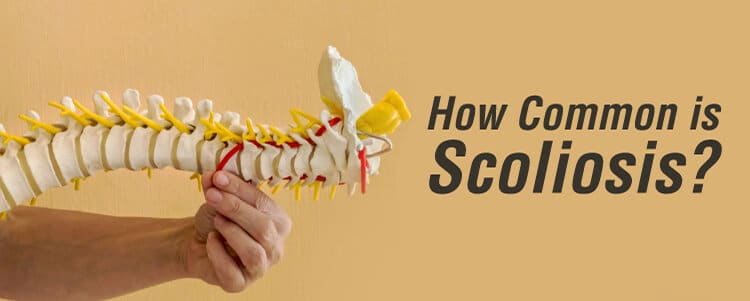 How Common is Scoliosis? Is Scoliosis Common?