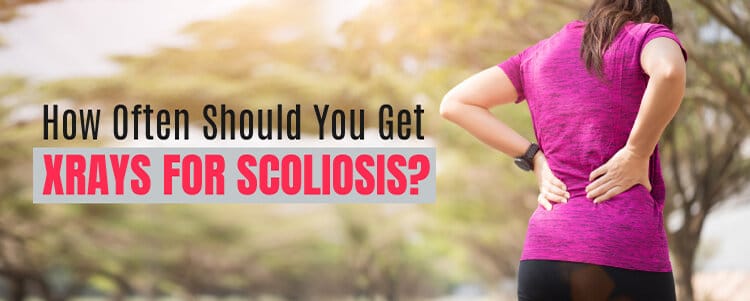 How Often Should You Get X-Rays For Scoliosis?