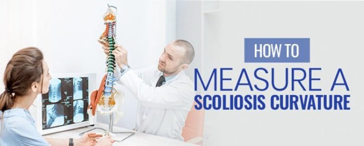 How to Measure a Scoliosis Curvature