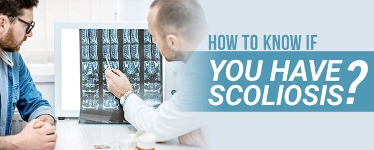 how to Bknow if Byou have scoliosis