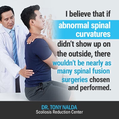 i believe if abnormal spinal curvatures