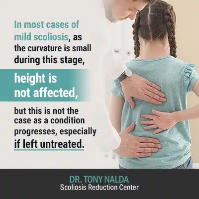 in most cases of mild scoliosis 400 in most cases of mild scoliosis
