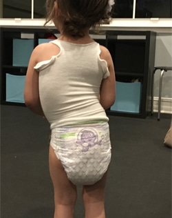 infant pre treatment posture