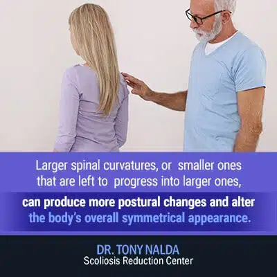 larger spinal curvatures 400 larger spinal curvatures