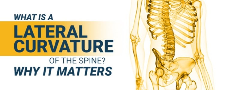 What Is A Lateral Curvature Of The Spine? Why It Matters