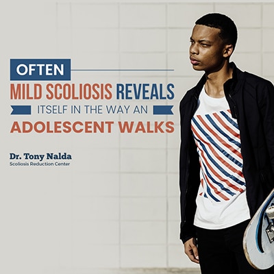 often mild scoliosis reveals small often mild scoliosis reveals small