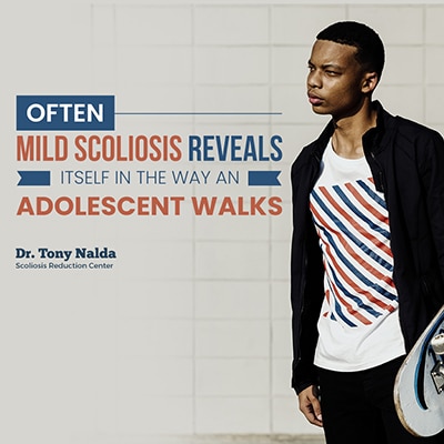 often mild scoliosis reveals small