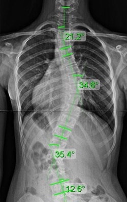 teen 3 weeks in