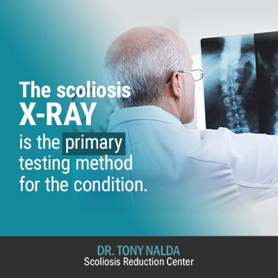 the scoliosis xray