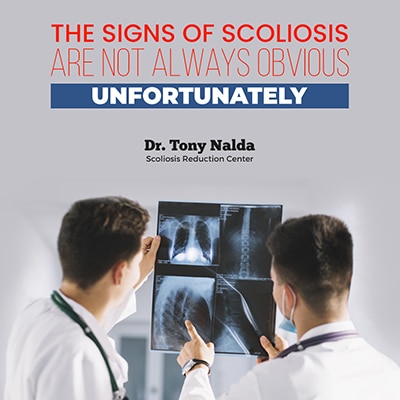the signs of scoliosis are not always small