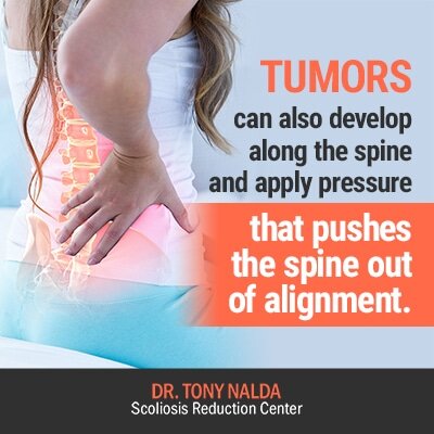 tumors can also develop