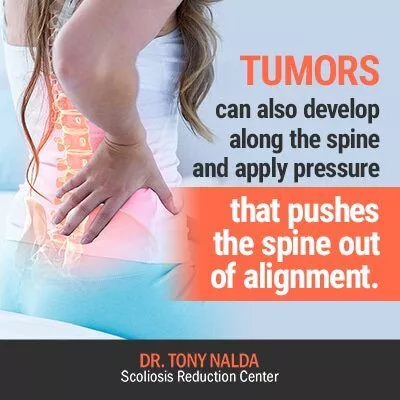 tumors can also develop 400 tumors can also develop