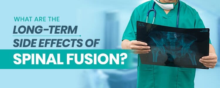 what are the long term side effects of spinal fusion