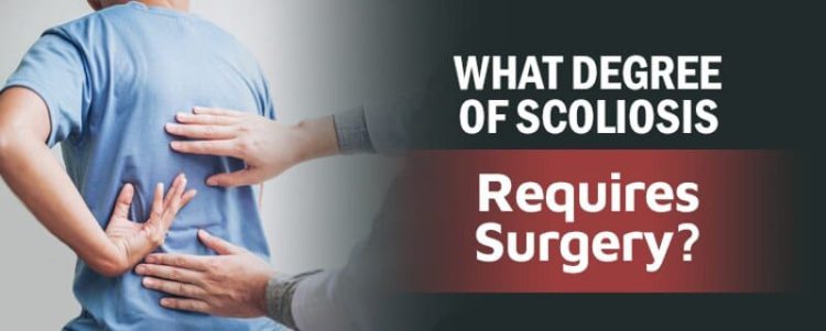 What Degree of Scoliosis Requires Surgery?