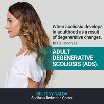 when scoliosis develops