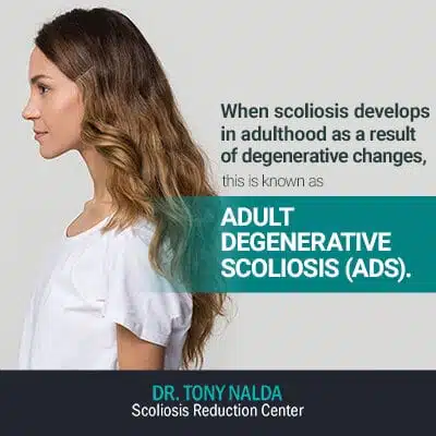 when scoliosis develops 400 when scoliosis develops