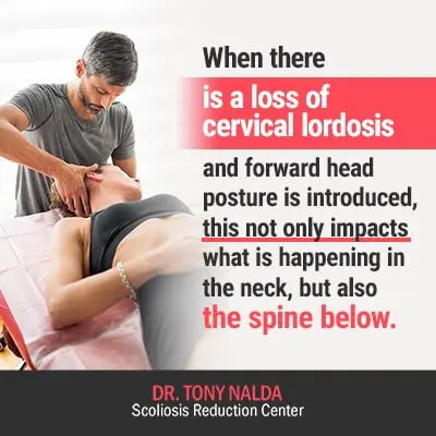Cervical Lordosis And What Causes Loss Of Cervical Lordosis