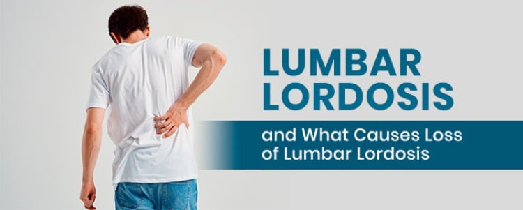 Lumbar Lordosis and What Causes Loss of Lumbar Lordosis