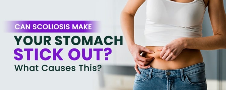 can scoliosis make your stomach stick out