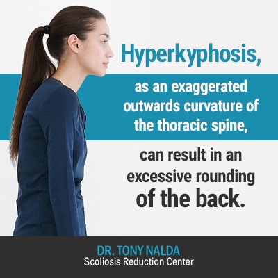 hyperkyphosis as an exaggerated outwards 400