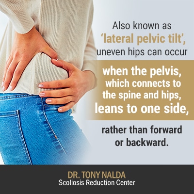 also known as lateral pelvic tilt 400