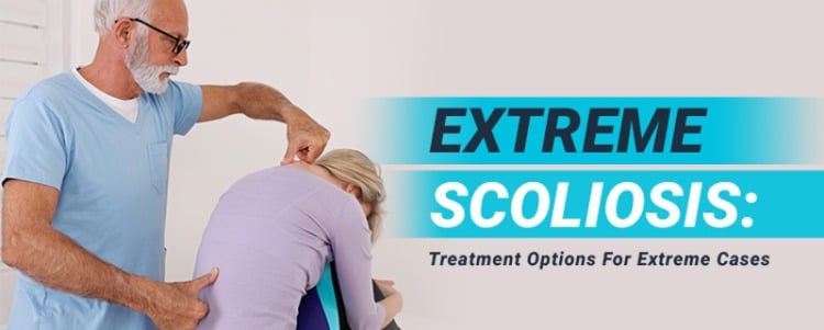 Extreme Scoliosis: Treatment Options For Extreme Cases