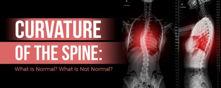 Curvature Of The Spine: What Is Normal? What Is Not Normal?