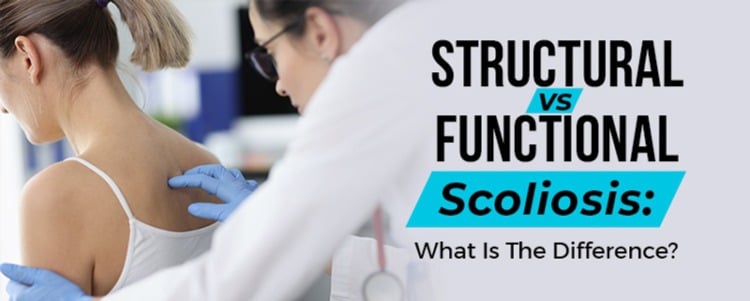 Structural vs Functional Scoliosis: What Is The Difference?