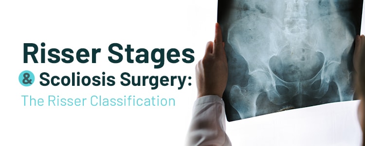 Risser Stages & Scoliosis Surgery: The Risser Classification