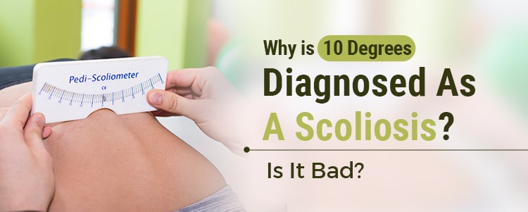 Why Is 10 Degrees Diagnosed As A Scoliosis? Is It Bad?