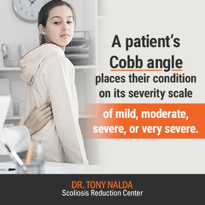 a patients cobb angle places 400