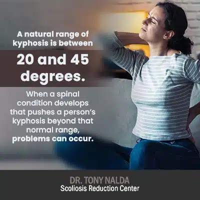 a natural range of kyphosis 400 a natural range of kyphosis 400