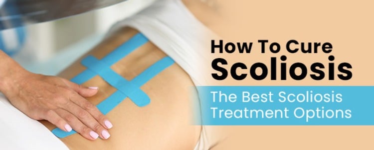 How To Cure Scoliosis: The Best Scoliosis Treatment Options