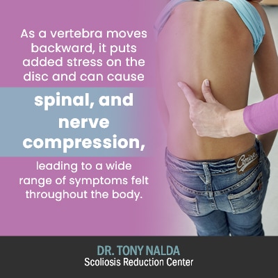 as a vertebra moves backward 400