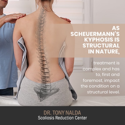 as scheuermanns kyphosis is structural 400