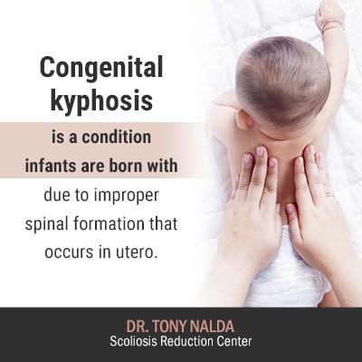 congenital kyphosis is a condition 400