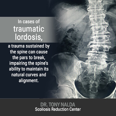 in cases of traumatic lordosis 400