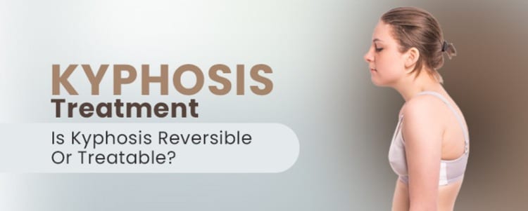 Kyphosis Treatment: Is Kyphosis Reversible Or Treatable?