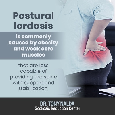 postural lordosis is commonly caused 400