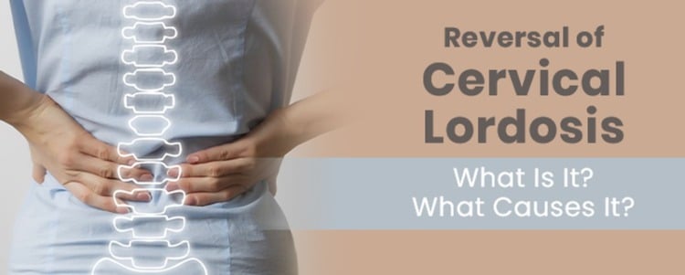 Reversal of Cervical Lordosis: What Is It? What Causes It?