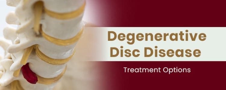 Degenerative Disc Disease Treatment Options