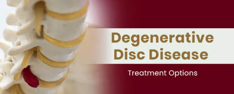 https://www.scoliosisreductioncenter.com/wp-content/uploads/2021/10/degenerative-disc-disease-treatment.jpg.webp